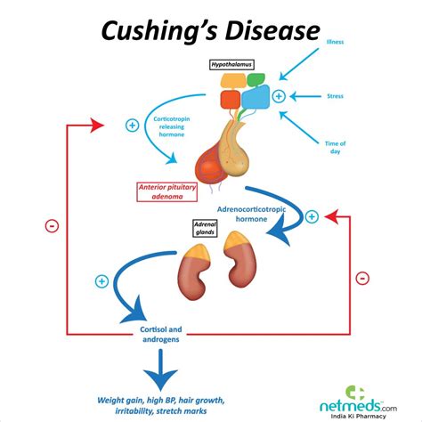 cushing syndrome pathophysiology